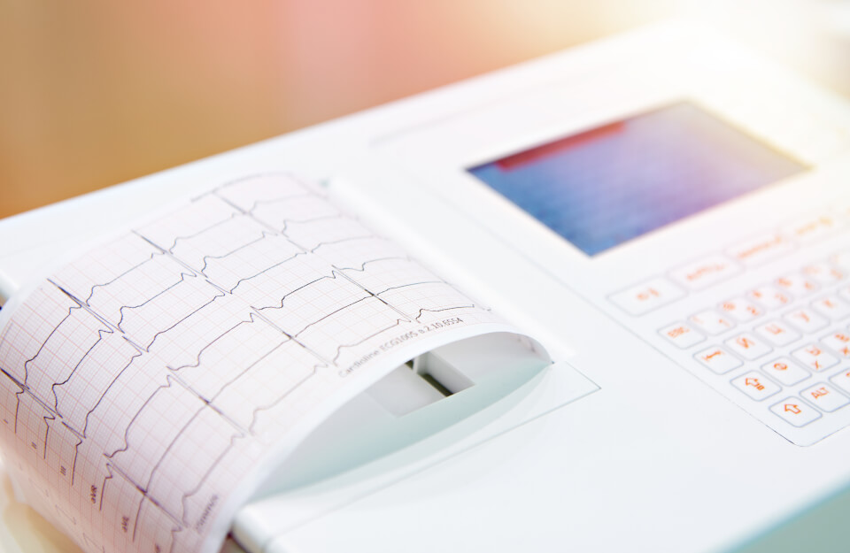 Electrocardiograma